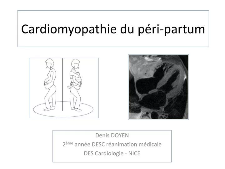 cardiomyopathie du p ri partum