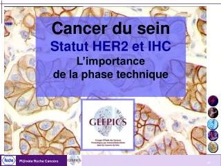 Cancer du sein Statut HER2 et IHC L’importance de la phase technique