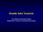 Double Inlet Ventricle