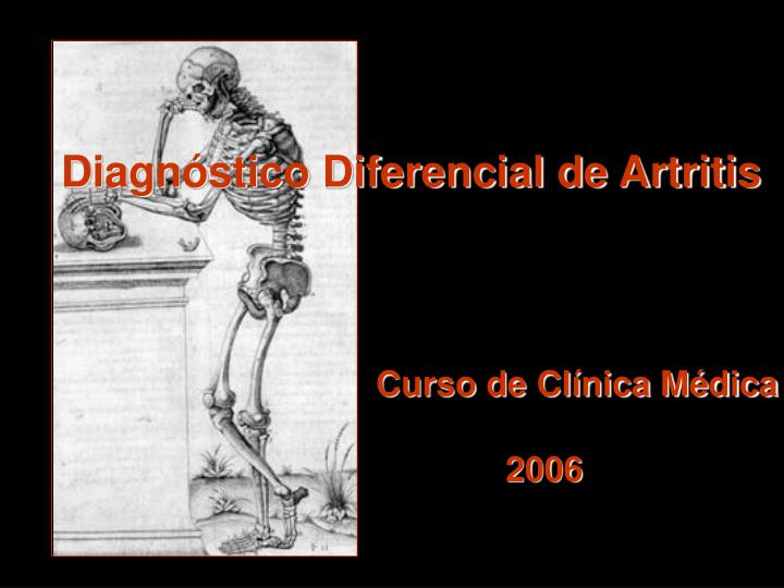 diagn stico diferencial de artritis curso de cl nica m dica 2006