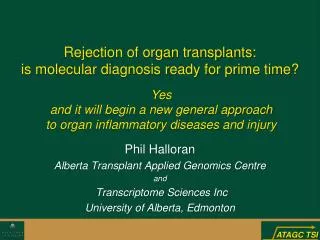 Rejection of organ transplants: is molecular diagnosis ready for prime time?