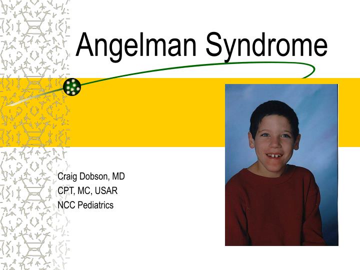 angelman syndrome