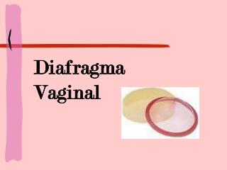 Diafragma Vaginal