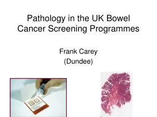 Pathology in the UK Bowel Cancer Screening Programmes