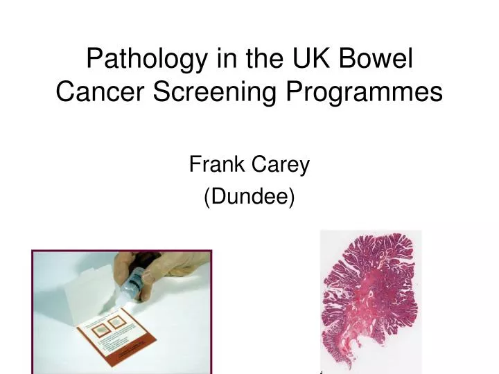 pathology in the uk bowel cancer screening programmes