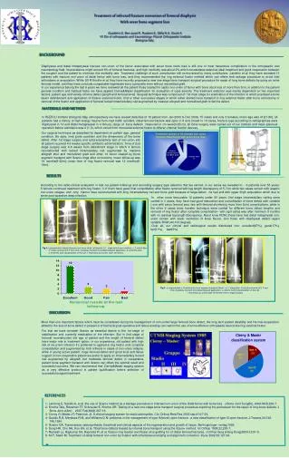 Treatment of infected fracture non-union of femoral diaphysis With sever bone segment loss Gualdrini.G, Ben ayad.R, Rust