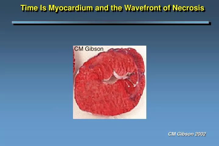 time is myocardium and the wavefront of necrosis