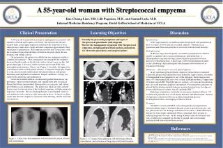 A 55-year-old woman with Streptococcal empyema Kuo-Chiang Lian, MD, Lilit Pogosian, M.D., and Samuel Lada, M.D.