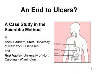 An End to Ulcers?