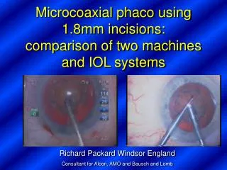 Microcoaxial phaco using 1.8mm incisions: comparison of two machines and IOL systems