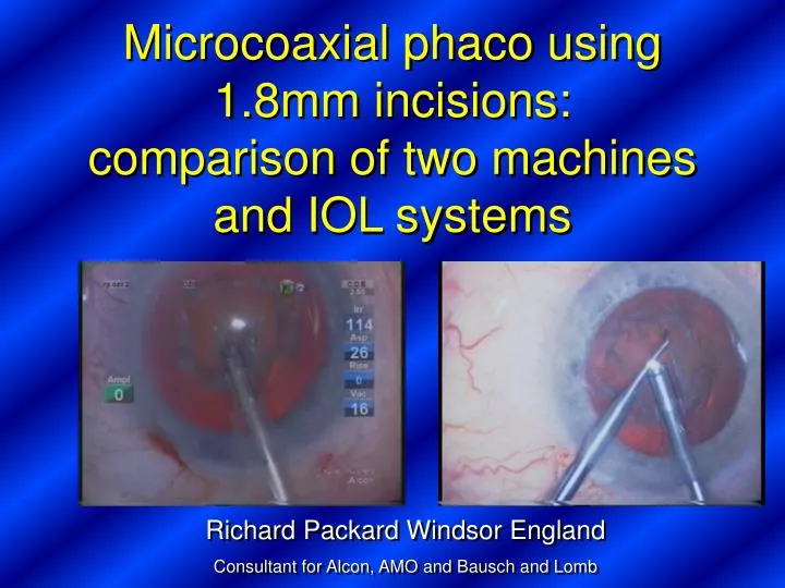 microcoaxial phaco using 1 8mm incisions comparison of two machines and iol systems
