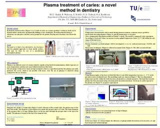 P lasma treatment of caries : a novel method in dentistry