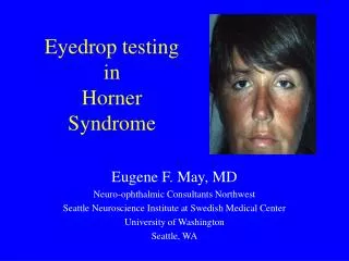 Eyedrop testing in Horner Syndrome