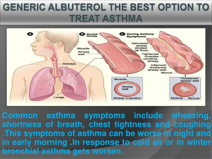 generic albuterol the best option to treat asthma