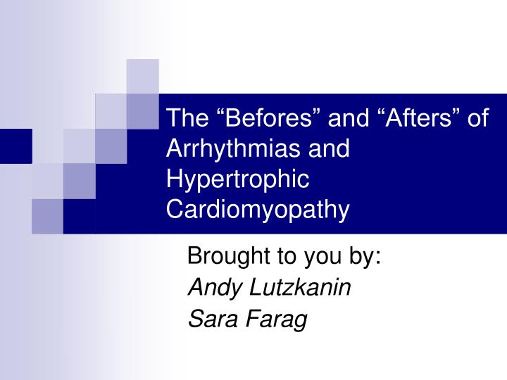the befores and afters of arrhythmias and hypertrophic cardiomyopathy