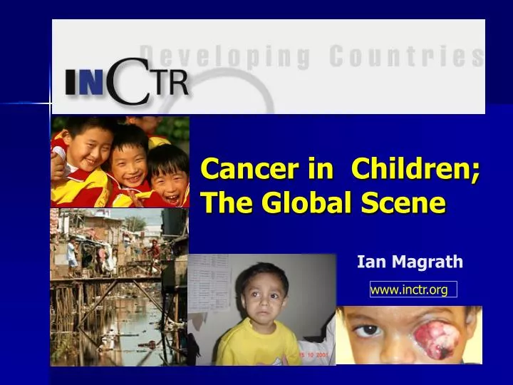 cancer in children the global scene