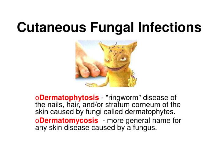 cutaneous fungal infections