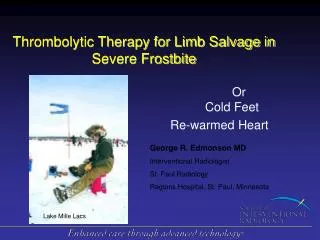 Thrombolytic Therapy for Limb Salvage in Severe Frostbite