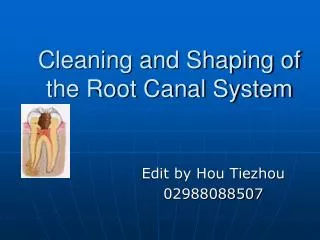 Cleaning and Shaping of the Root Canal System