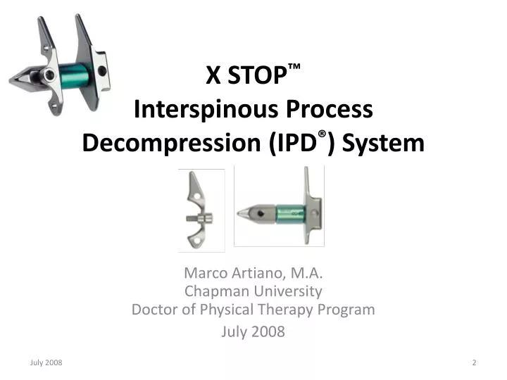 x stop interspinous process decompression ipd system