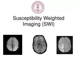 Susceptibility Weighted Imaging (SWI)