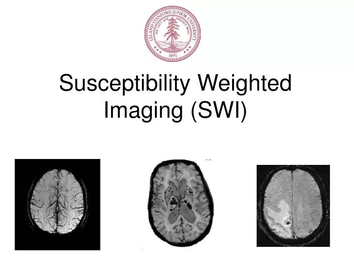 susceptibility weighted imaging swi