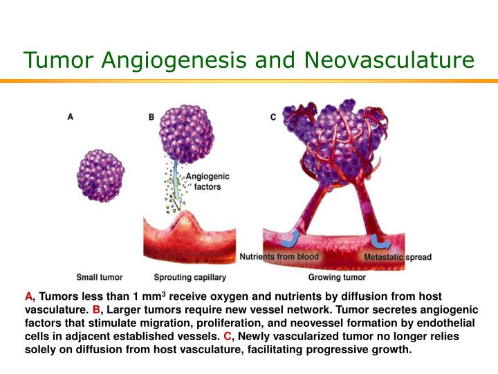 tumor angiogenesis and neovasculature