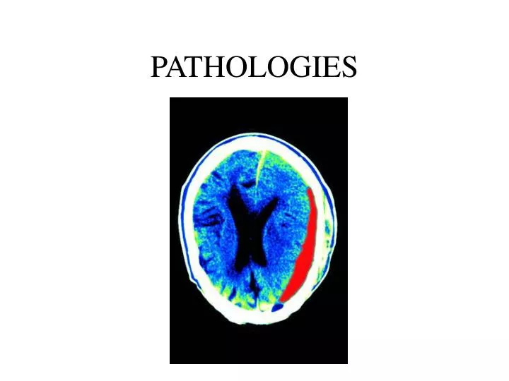 pathologies