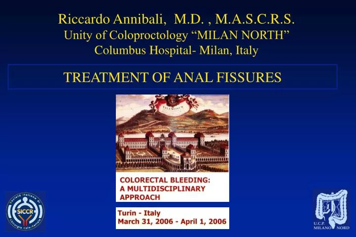 treatment of anal fissures