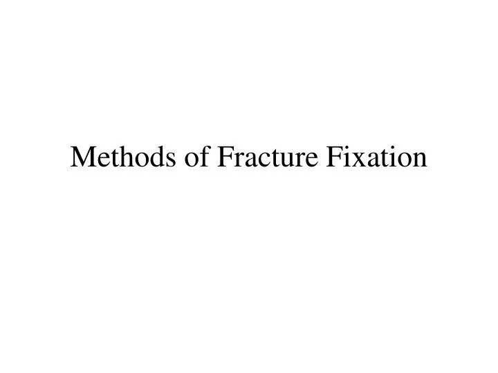 methods of fracture fixation