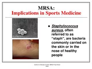 MRSA: Implications in Sports Medicine