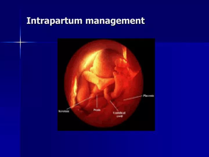 intrapartum management