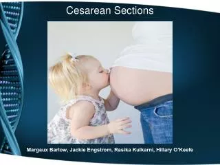 Cesarean Sections