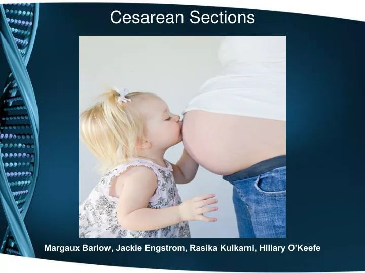 cesarean sections