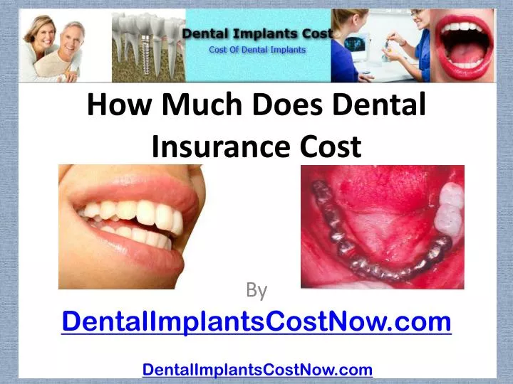 how much does dental insurance cost
