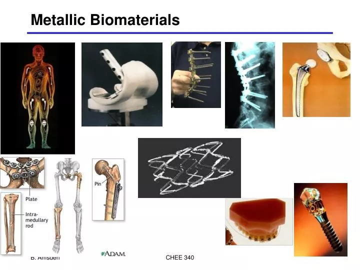 metallic biomaterials