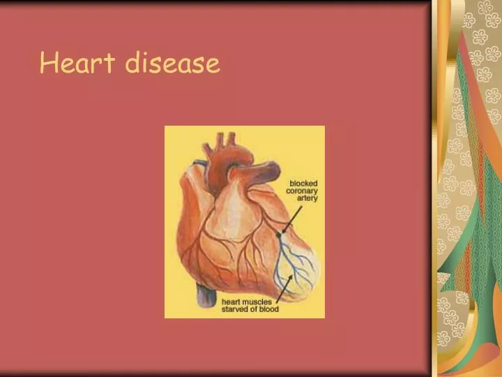 heart disease