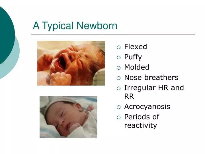 a typical newborn