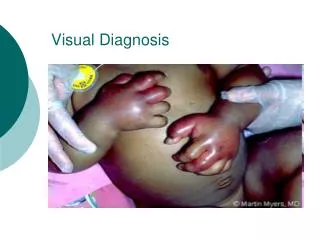 Visual Diagnosis