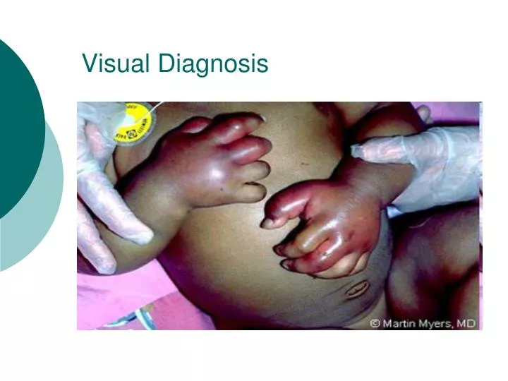 visual diagnosis