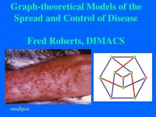 Graph-theoretical Models of the Spread and Control of Disease Fred Roberts, DIMACS