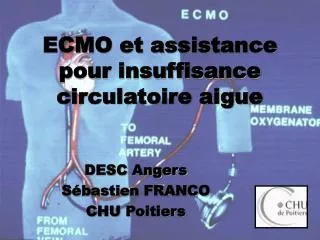 ECMO et assistance pour insuffisance circulatoire aigue
