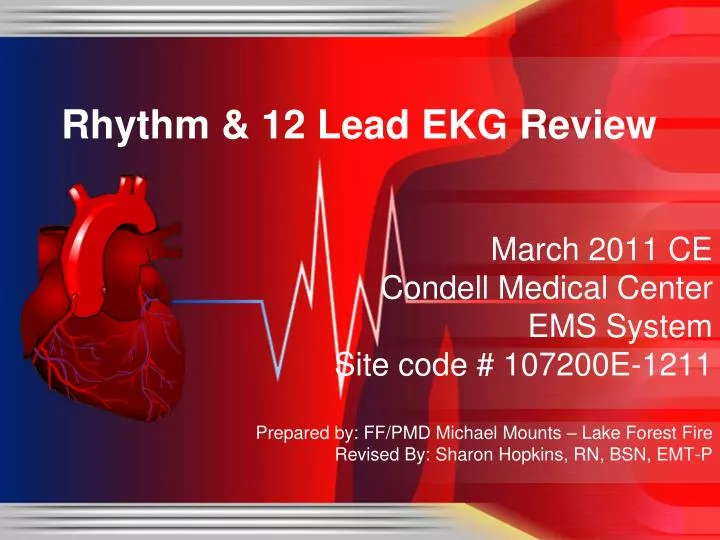 rhythm 12 lead ekg review