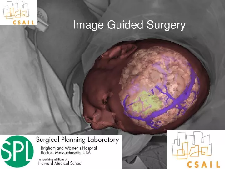 image guided surgery