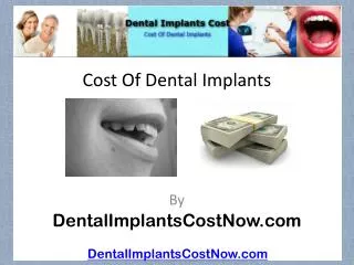 Cost Of Dental Implants