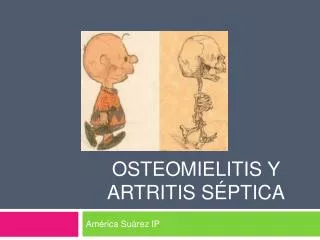 Osteomielitis y artritis séptica
