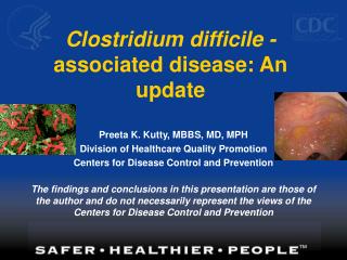 Clostridium difficile - associated disease: An update