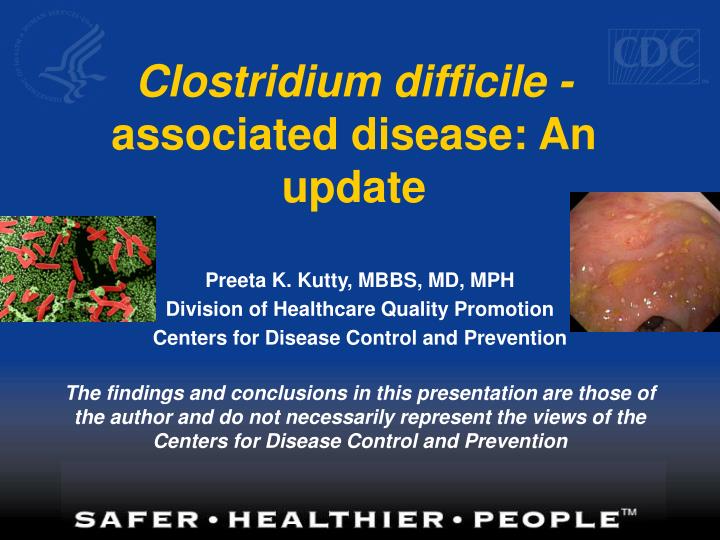 clostridium difficile associated disease an update