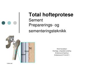 Total hofteprotese Sement Preparerings- og sementeringsteknikk