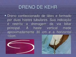 DRENO DE KEHR
